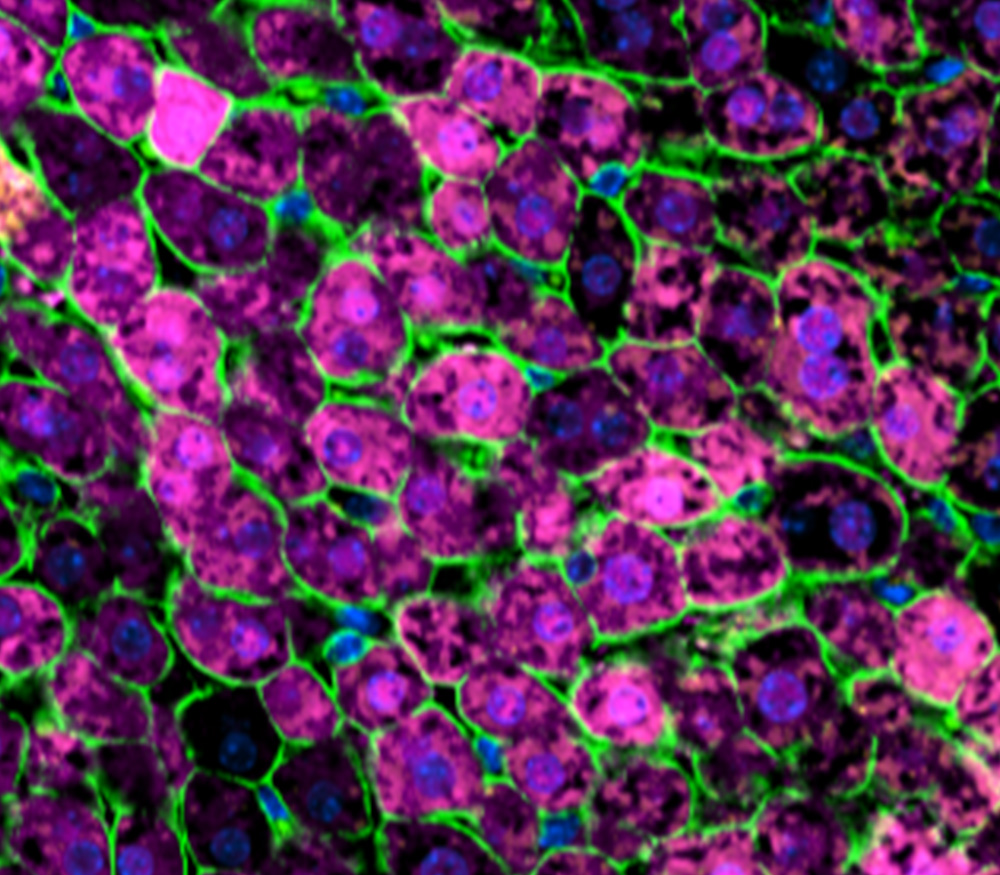 Hexagonal microscopy image showing cellular tropism of lipid nanoparticles in live-cell fluorescence assay as part of lipid nanoparticle preclinical screening MDC.