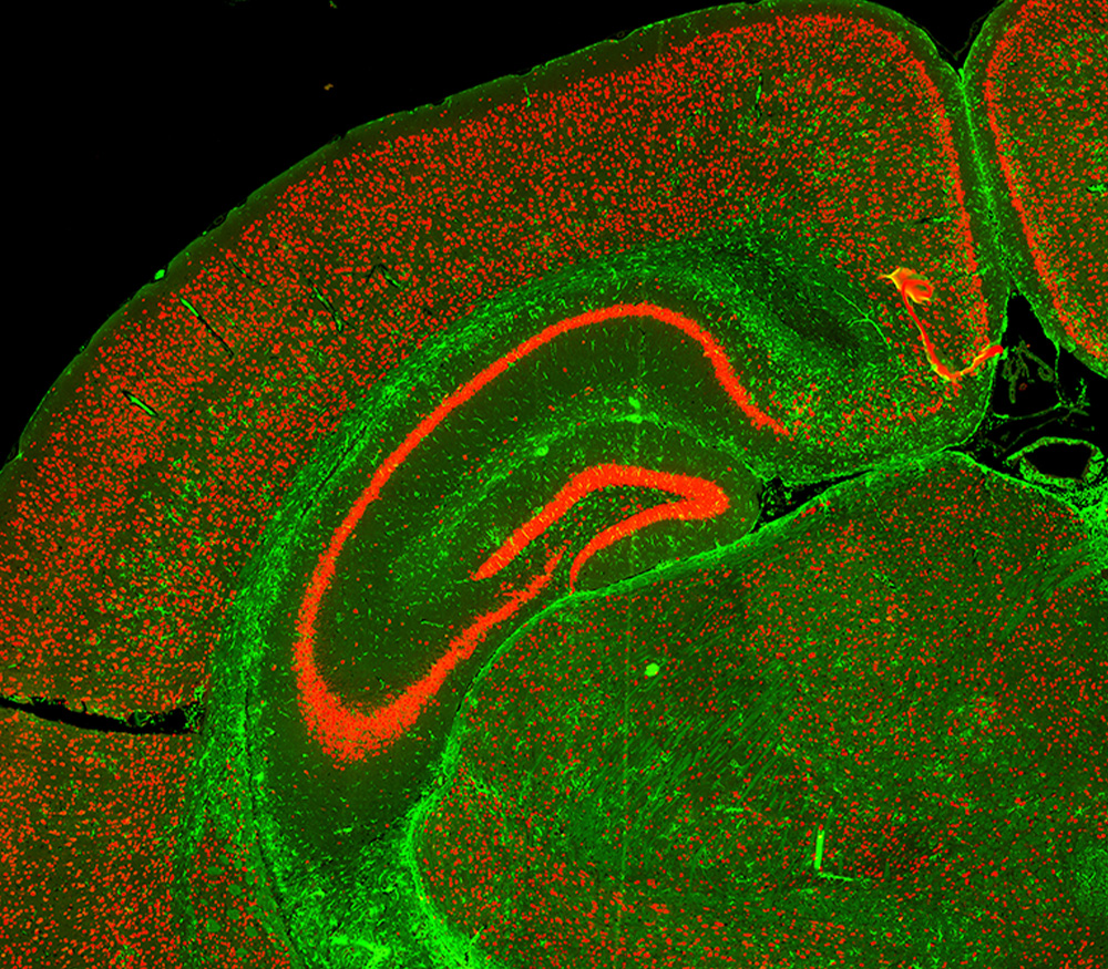 An image of the hippocampus region of the brain used in neurodegeneration research