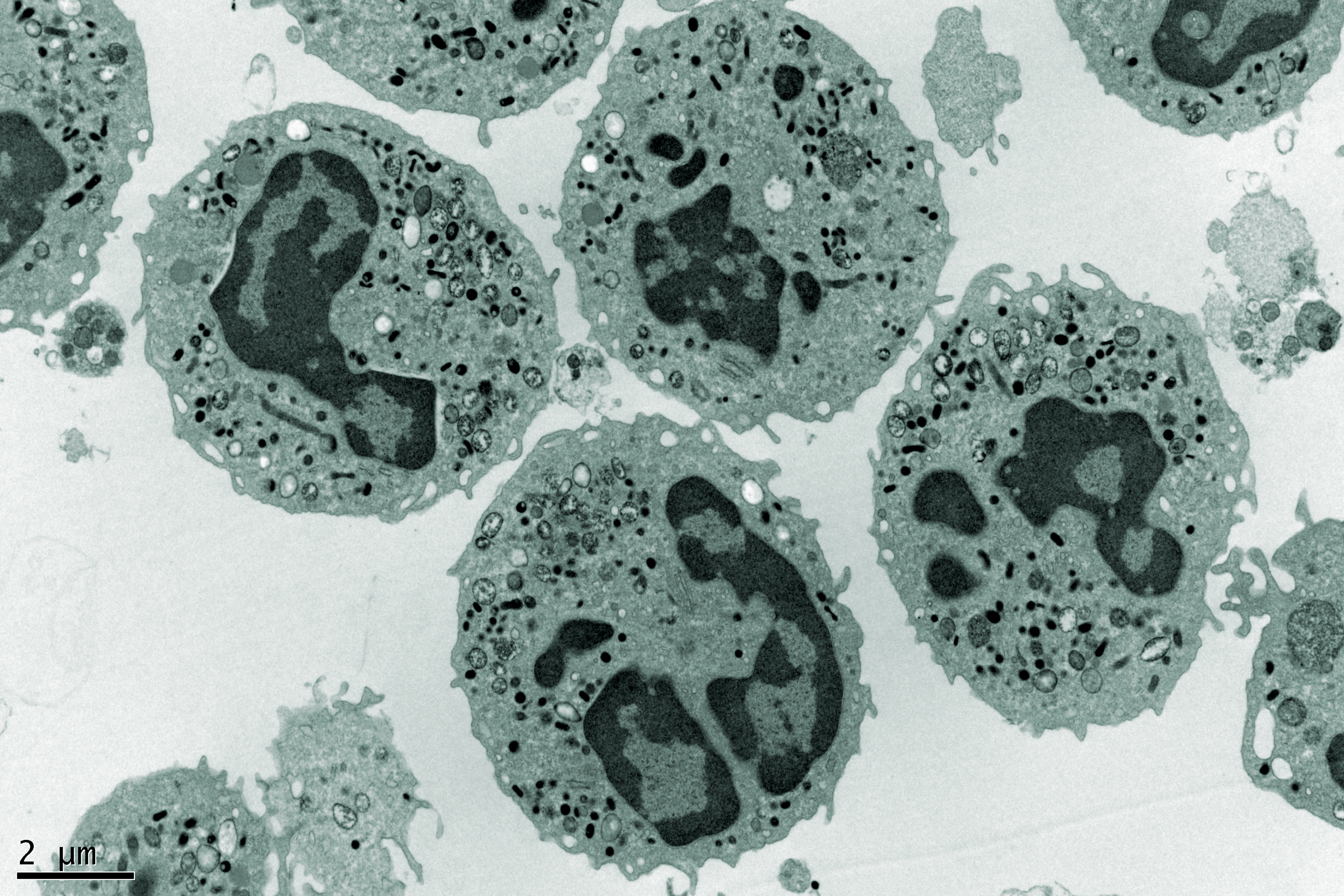 Electron Microscopy Photography of a group of human Neutrophils