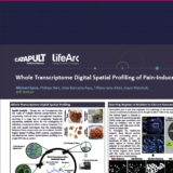 ELRIG Poster Whole Transcriptome Digital Spatial Profiling of Pain-Induced DRGs