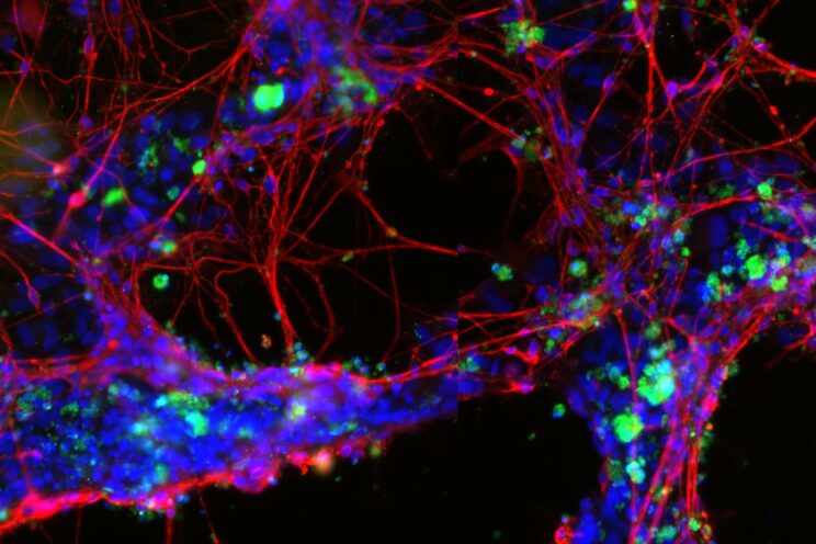 Human iPSC-derived tricultures of neurons (β3-tubulin, green), astrocytes (GFAP, white) and microglia (IBA1, magenta). Credit: Medicines Discovery Catapult
