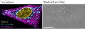 Images showing fluorescence and widefield transmitted comparison.