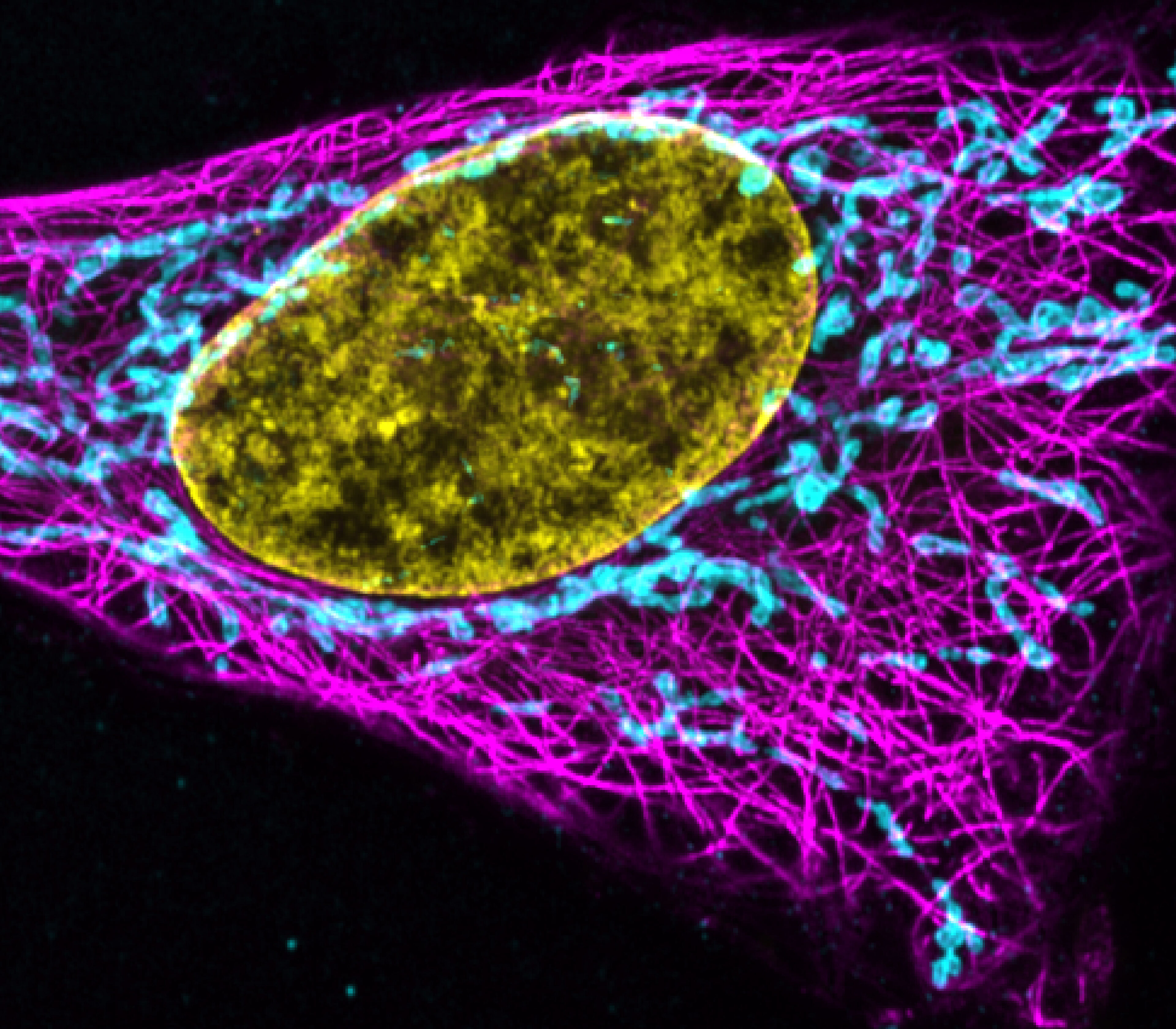 Photon and phenotype blog image of fluorescence and transmitted light microscopy