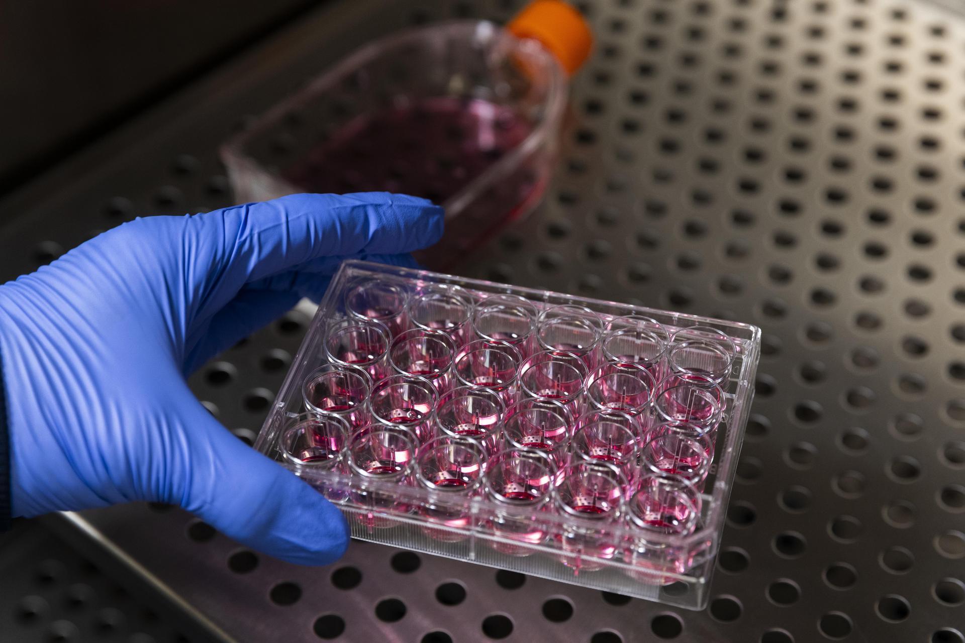 A well plate of cells is being placed in an incubator for immunology drug discovery.