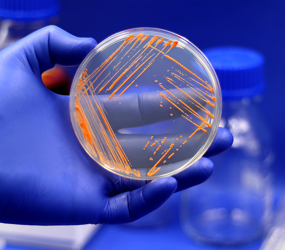 Gloved hand holding a petri dish showing orange bacterial colonies for infectious disease drug discovery research