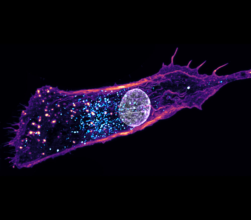 Primary-M2-macrophage-internalising-a-drug-molecule.-Labels-are-actin-purple-drug-cyan-nucleus-grey