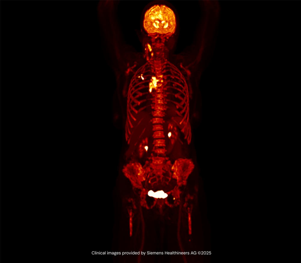 Medical imaging of human body anatomy