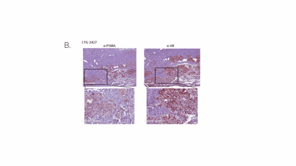 Figure B: PSMA and AR expression and localization in CTG-2427 PDX by IHC.