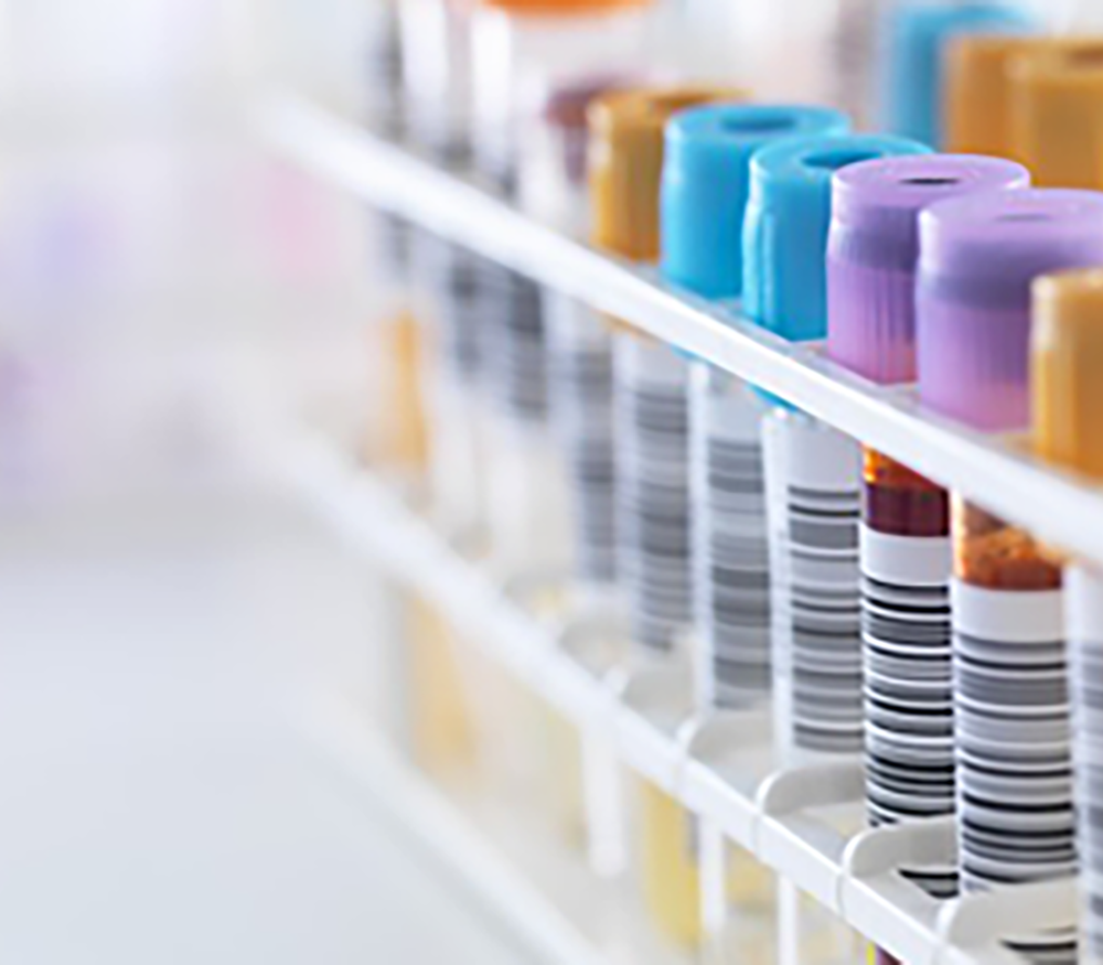 A picture of human samples from Biobanks used for accessing clinical samples