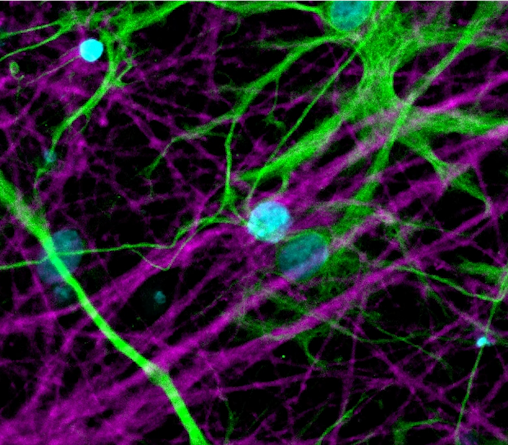 neurons under a microscope