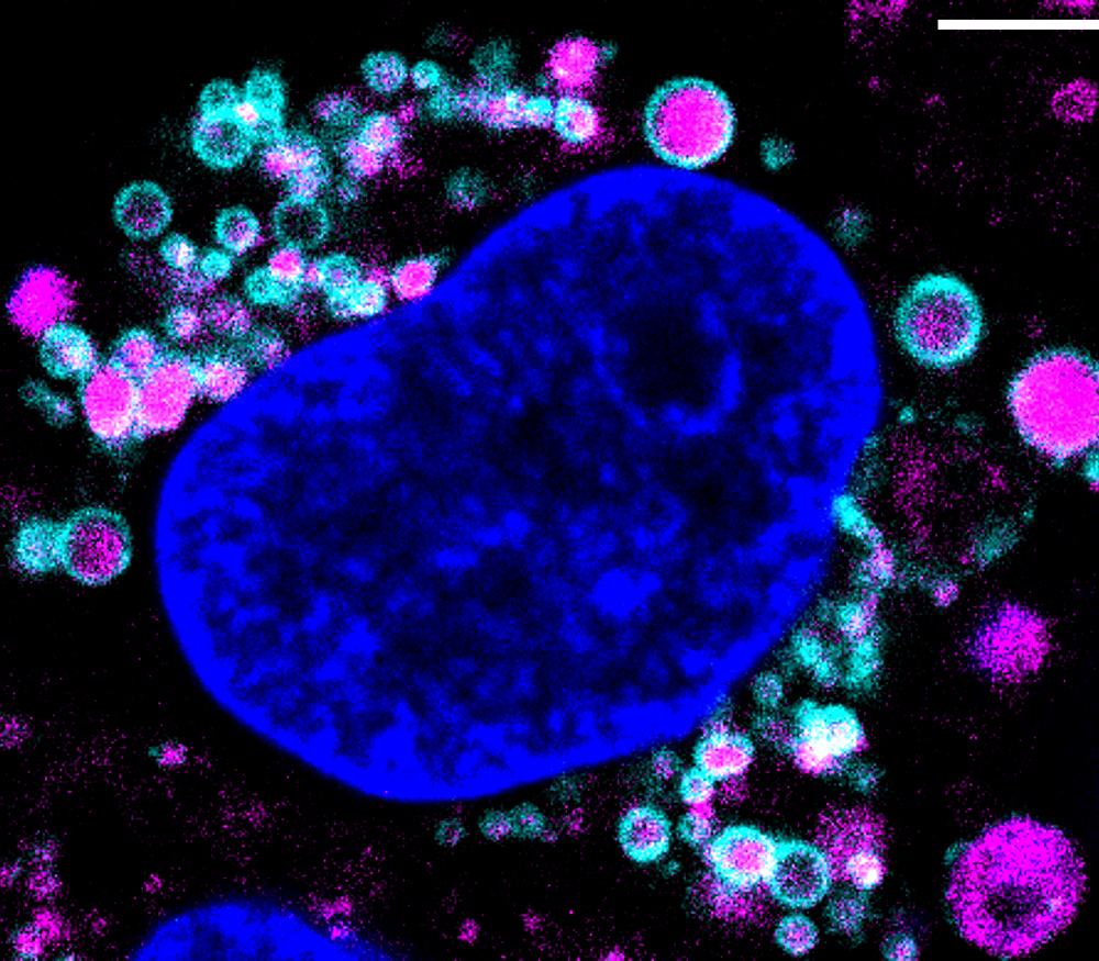 BT-474 cell expressing endogenously tagged Rab7a (late endosomes) stained with lysotracker (lysosomes) and DAPI (DNA).